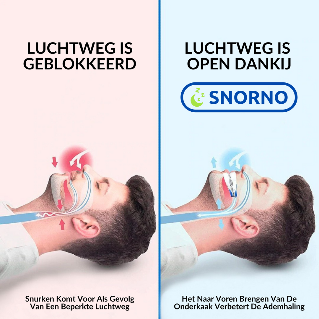 Comfortabele anti-snurk beugel, speciaal gemaakt voor een betere nachtrust en minder snurkklachten.