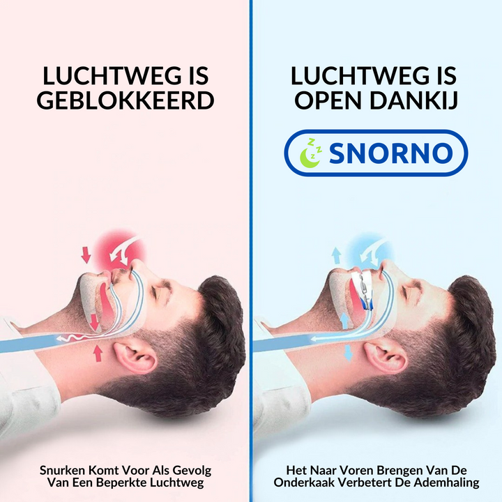 Comfortabele anti-snurk beugel, speciaal gemaakt voor een betere nachtrust en minder snurkklachten.