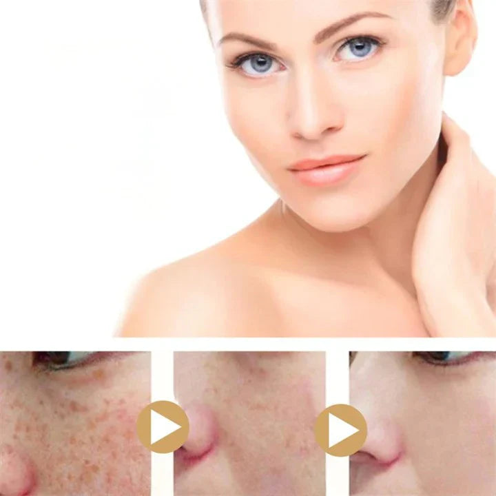 Natuurlijk kurkuma serum voor de huid; vermindert donkere vlekken en pigmentvlekken voor een heldere, stralende teint.