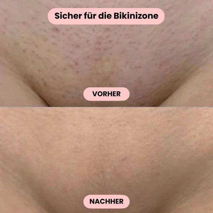 Dames bikini trimmer, USB oplaadbaar, voor pijnloze haarverwijdering op gevoelige plekken.
