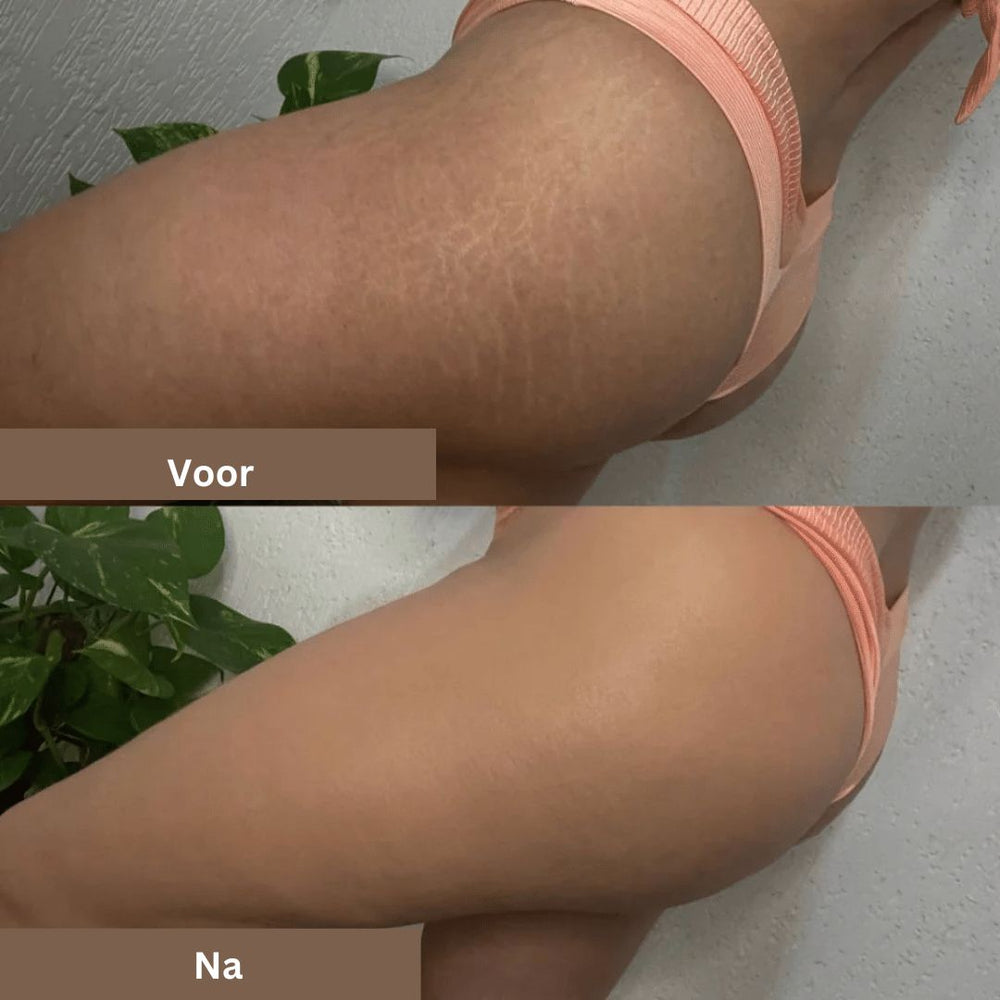 Langdurige waterdichte concealer, ideaal voor het camoufleren van littekens en tatoeages op elk huidtype.