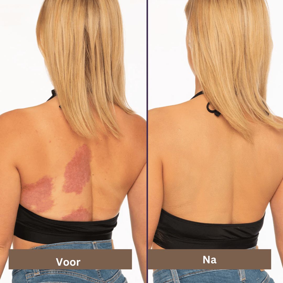 Premium waterbestendige make-up: een hoogdekkende concealer voor gezicht en lichaam, met langdurig resultaat.