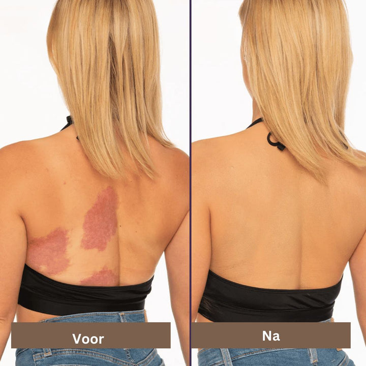 Premium waterbestendige make-up: een hoogdekkende concealer voor gezicht en lichaam, met langdurig resultaat.